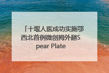 十堰人医成功实施鄂西北首例微创拇外翻Spear Plate髓内板矫形术
